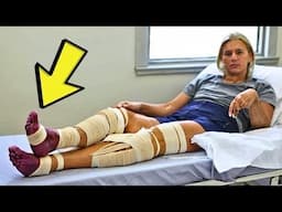 Cruel Kids Notice Bizarre Shape in This Girl’s Legs, Put Her in the ER Immediately