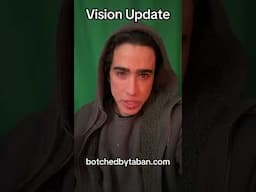 Vision Update 😵