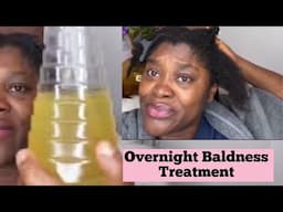 Overnight Baldness And Alopecia Regrowth Treatment Stop hair loss faster accelerate hair growth