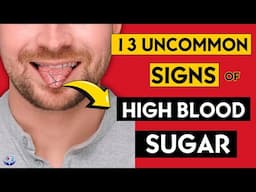 13 Uncommon Signs Your Blood Sugar is Consistently High