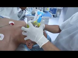 A Gentleman’s Smooth Anesthesia Process