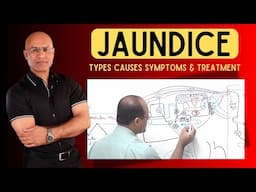 Jaundice | Types Causes Symptoms and Treatment