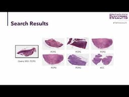 KimiaNet - Training a Histopathology Deep Network from Scratch