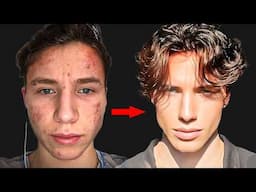 Ugly Guy Glows Up And Becomes Calvin Klein Model (full method explained)