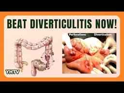 Diverticulitis Diet: Best Foods, Tips & Meal Plans to Heal Diverticulitis