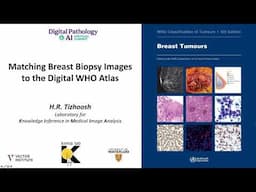 Matching Breast Biopsy Images to the Digital WHO Atlas