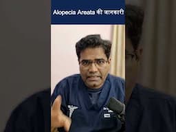 alopecia areata की जानकारी #एलोपेसिया