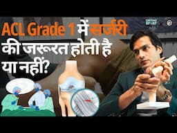 ACL Grade 1 में सर्जरी की जरूरत होती है या नहीं? #aclgradeonetear #acltear