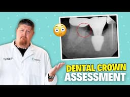 Root Canals, Cavities, and Dental Crowns Assessment in a Dental X--Ray