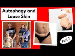 Fasting, Autophagy, and Reducing Loose Skin