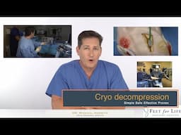 Cryo neuroma decompression update 2023