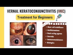 How to Treat Vernal Keratoconjunctivitis: What You Need to Know