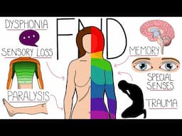 Functional Neurological Disorder (FND) Explained Clearly