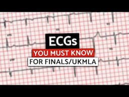 MUST KNOW ECGs for Med School Finals/UKMLA/PLAB | Rapid High-Yield ECGs