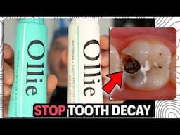 Best Toothpaste to STOP Tooth Decay | Fluoride vs Hydroxyapatite