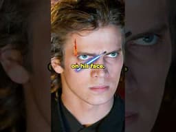 How Did Anakin Get His Scar? #starwars