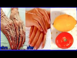 82 years grandma remove wrinkles from hands forever fast with lemon tomato / dry hands home remedies