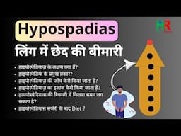 Hypospadias in hindi | हाइपोस्पेडियाज़ का इलाज कैसे किया जाता है |