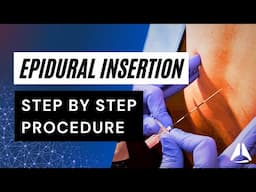 Epidural Insertion Technique | #anesthesiology #anesthesia #epidural