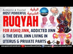 MOST POWERFUL RUQYAH FOR ASHIQ JINN, ADDICTED JINN & THE DEVIL JINN LIVING IN UTERUS & PRIVATE PARTS