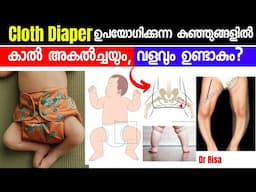 Diaper ഉപയോഗിക്കുന്നെ കുഞ്ഞിനെ കാൽ വളവ്, അകൽച്ചക്ക് കാരണം?|Cloth Diapers & Baby Walking| Bow Leg