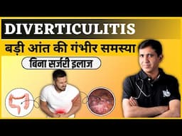 MIND-BLOWING Diverticulitis Secrets You Never Knew Existed