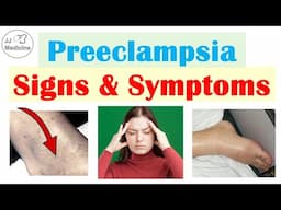 Recognizing the Signs and Symptoms of Preeclampsia