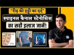 Spinal Canal Stenosis | क्या है स्पाइनल स्टेनोसिस ? जानिए इसके लक्षण और इलाज ! | Dr. Ramdeo Lamoria