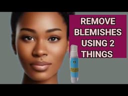 Mix Lemon Juice and Milk to Remove Blemishes and Spots