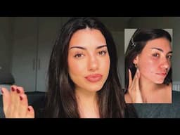 makeup tutorial for acne prone skin (easy - step by step)