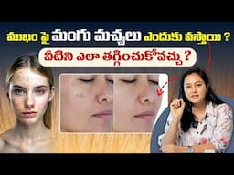 మంగు మచ్చలు ఎలా పోతాయి ? - Causes Of Mangu Machalu and How To Remove | Dr DeepthI Devarakonda | THF