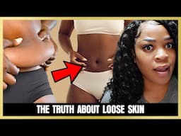 20lbs in 7 days 🔥 how I reduced loose skin after weight loss | how to get rid of loose skin