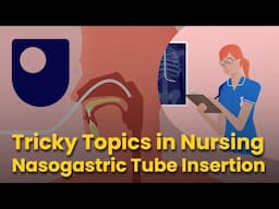 Tricky Topics in Nursing - Nasogastric Tube Insertion