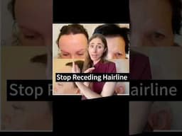 Stop Receding Hairline #dermatologist