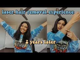 my laser hair removal experience! | 2 years later