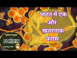 Black and white fungus ke bad ab yellow fungus infection | Yellow fungus | COVID 19 | Coronavirus