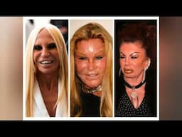 Top 10 Celebrity Plastic Surgeries Fails