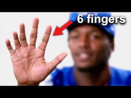 Meet The 6 Fingered Beast NFL Players FEAR..