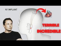 How Elon Musk's Neuralink’s brain implant will save data in the Brain