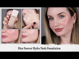 Dior | Forever Hydra Nude Foundation | Shade 0N Neutral | 12-Hour Wear Test on Acne-Textured Skin