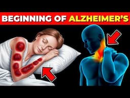 7 EARLY SIGNS of ALZHEIMER’S DISEASE that you SHOULD NEVER IGNORE!