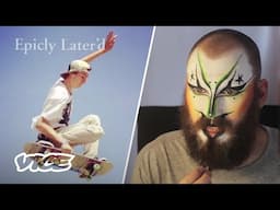 Pro Skating & Drag: Meet Chandler Burton | Epicly Later'd