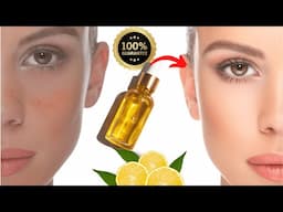 Vitamin C Serum🌹 vitamin C toremove Dark Spots, Pigmentation, and Sun Tan provides Skin Whitening!