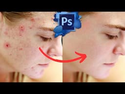 Photoshop: remove blemishes with AI