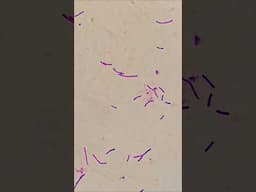 Listeria monocytogenes under microscope #shorts #short #shortvideo