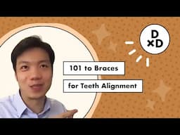 101 to Braces for Teeth Alignment! | DoctorxDentist