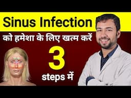 साइनस का 2-दिन में जड़ से इलाज | sinus treatment home tips | sinus ka gharelu upchar | sinus ka ilaj