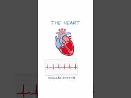 AF/AFib - EXPLAINED #healthsketch #shorts