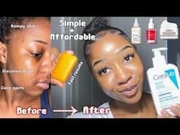 HOW TO GET CLEAR & SMOOTH SKIN | Simple Step by step routine to brighten dark marks + discolouration