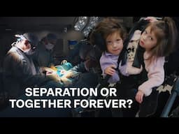 The Heartbreaking Choice of Separation | Extraordinary Twins (4K Documentary)